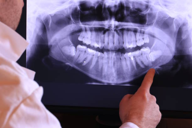 Best Emergency Dentist for Knocked-Out Tooth in East Lansing, MI
