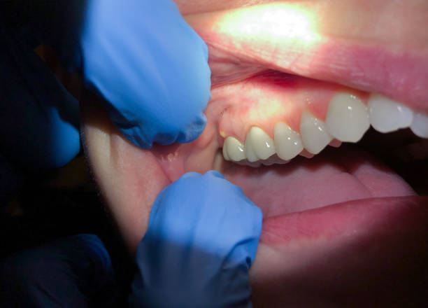 Best Emergency Dentist for Special Needs Patients in East Lansing, MI
